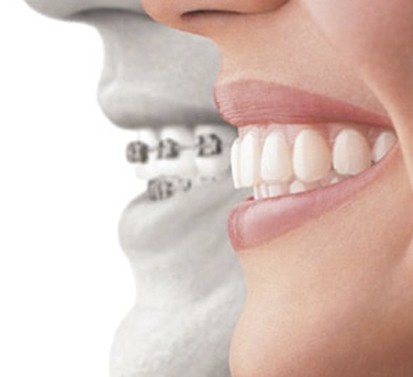 Laird Eglinton Dental - Orthodontics