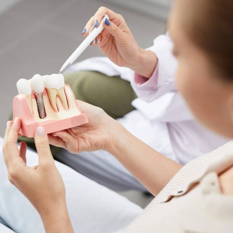 Dental Implants in Toronto