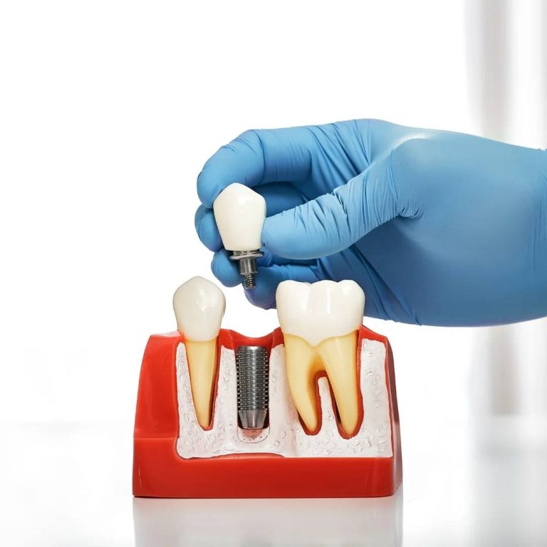 wisdom teeth removal Toronto ON